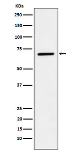 Anti-LTA4H Rabbit Monoclonal Antibody Boster Bio