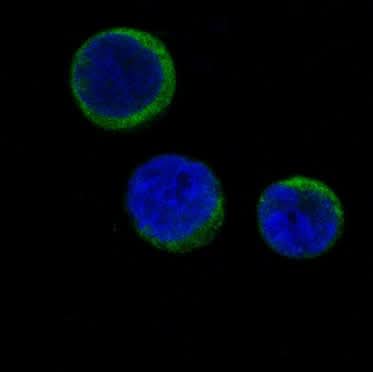 Anti-Ferritin FTH1 Rabbit Monoclonal Antibody Boster Bio
