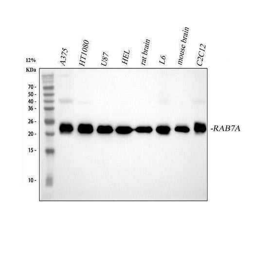 Anti-RAB7 RAB7A Rabbit Monoclonal Antibody Boster Bio