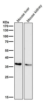 Anti-IGFBP7 Monoclonal Antibody Boster Bio