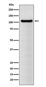 Anti-BRD2 Rabbit Monoclonal Antibody Boster Bio