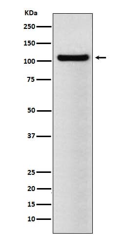 Anti-BRD2 Rabbit Monoclonal Antibody Boster Bio