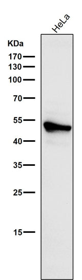 Anti-Cytokeratin 7 KRT7 Rabbit Monoclonal Antibody Boster Bio