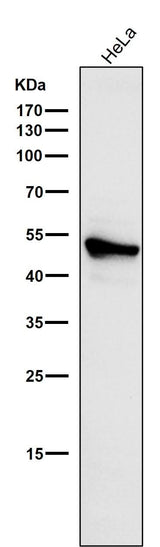 Anti-Cytokeratin 7 KRT7 Rabbit Monoclonal Antibody Boster Bio