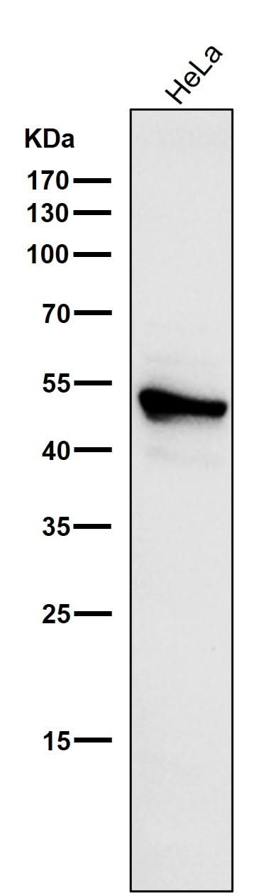 Anti-Cytokeratin 7 KRT7 Rabbit Monoclonal Antibody Boster Bio