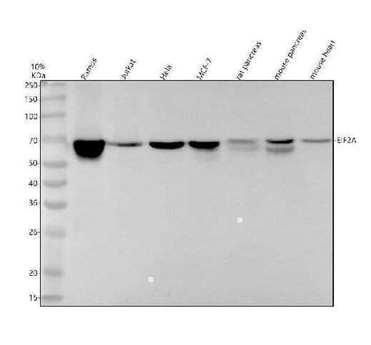Anti-eIF2A Rabbit Monoclonal Antibody Boster Bio