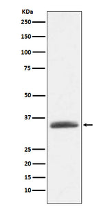 Anti-AMBP Rabbit Monoclonal Antibody Boster Bio