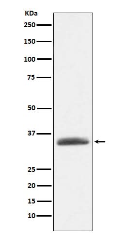 Anti-AMBP Rabbit Monoclonal Antibody Boster Bio