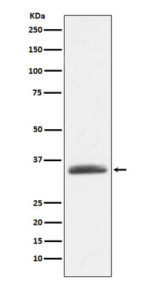 Anti-AMBP Rabbit Monoclonal Antibody Boster Bio