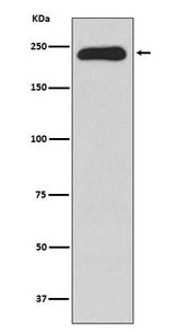 Anti-MYH11 Rabbit Monoclonal Antibody Boster Bio
