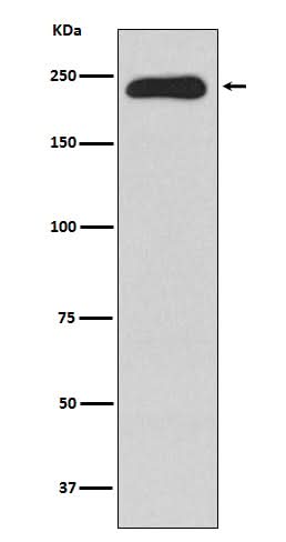 Anti-MYH11 Rabbit Monoclonal Antibody Boster Bio