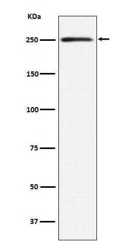 Anti-MYH11 Rabbit Monoclonal Antibody Boster Bio