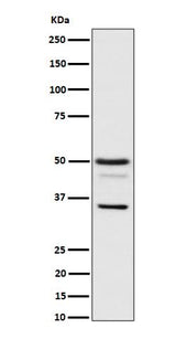 Anti-Bag1 Rabbit Monoclonal Antibody Boster Bio
