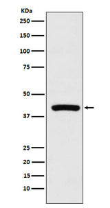 Anti-Cyclophilin 40 Rabbit Monoclonal Antibody Boster Bio