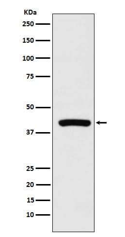 Anti-Cyclophilin 40 Rabbit Monoclonal Antibody Boster Bio