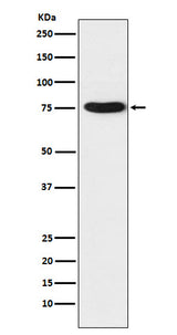 Anti-TRAP1 Rabbit Monoclonal Antibody Boster Bio