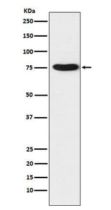 Anti-TRAP1 Rabbit Monoclonal Antibody Boster Bio