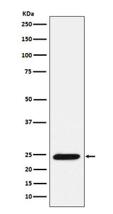 Anti-Bmf Rabbit Monoclonal Antibody Boster Bio