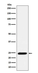 Anti-Bmf Rabbit Monoclonal Antibody Boster Bio