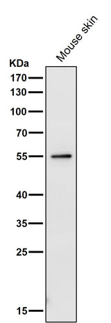 Anti-PRP19 PRPF19 Rabbit Monoclonal Antibody Boster Bio