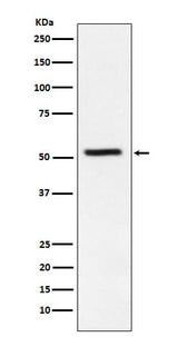 Anti-TrpRS Rabbit Monoclonal Antibody Boster Bio