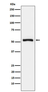 Anti-Tryptophanyl tRNA synthetase Rabbit Monoclonal Antibody Boster Bio