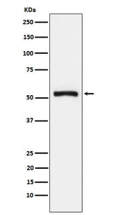 Anti-Tryptophanyl tRNA synthetase Rabbit Monoclonal Antibody Boster Bio