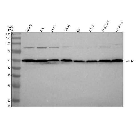 Anti-PABPN1 Rabbit Monoclonal Antibody Boster Bio
