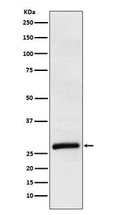 Anti-ApoM Rabbit Monoclonal Antibody Boster Bio