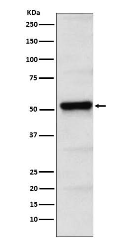 Anti-PICK1 Rabbit Monoclonal Antibody Boster Bio
