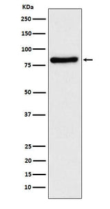 Anti-TLE1 Rabbit Monoclonal Antibody Boster Bio