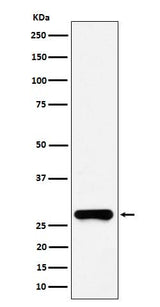Anti-GSTO1 Rabbit Monoclonal Antibody Boster Bio