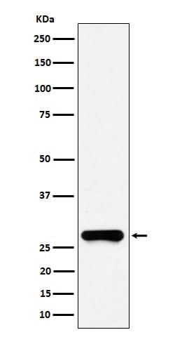 Anti-GSTO1 Rabbit Monoclonal Antibody Boster Bio
