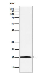 Anti-Ube2N / Ubc13 Rabbit Monoclonal Antibody Boster Bio