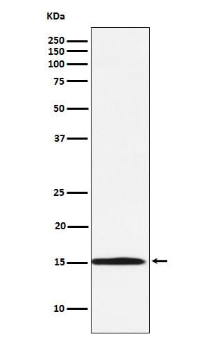 Anti-Ube2N / Ubc13 Rabbit Monoclonal Antibody Boster Bio