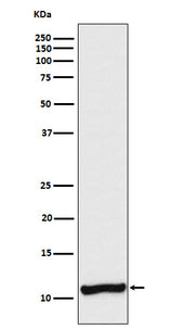 Anti-Cellubrevin Rabbit Monoclonal Antibody Boster Bio