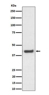 Anti-MVK Rabbit Monoclonal Antibody Boster Bio