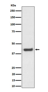 Anti-MVK Rabbit Monoclonal Antibody Boster Bio
