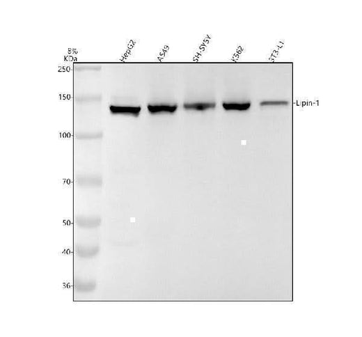 Anti-Lipin 1 Rabbit Monoclonal Antibody Boster Bio