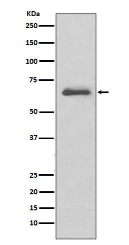 Anti-IRAK3/Irak M Rabbit Monoclonal Antibody Boster Bio