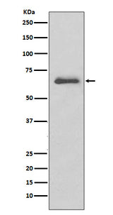 Anti-IRAK3/Irak M Rabbit Monoclonal Antibody Boster Bio