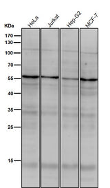 Anti-TRF1 TERF1 Rabbit Monoclonal Antibody Boster Bio