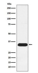 Anti-Syntenin Rabbit Monoclonal Antibody Boster Bio