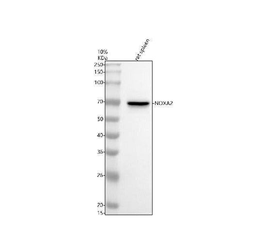 Anti-NOXA2/p67phox Rabbit Monoclonal Antibody Boster Bio
