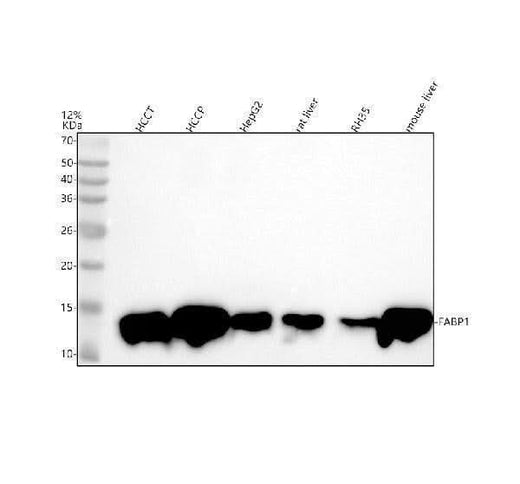 Anti-FABP1/L Fabp Rabbit Monoclonal Antibody Boster Bio