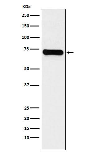 Anti-LysRS Rabbit Monoclonal Antibody Boster Bio