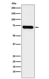 Anti-LysRS Rabbit Monoclonal Antibody Boster Bio