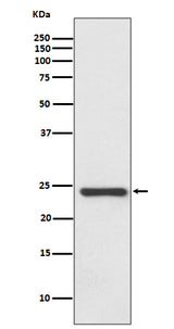 Anti-HSPB8/HSP22 Rabbit Monoclonal Antibody Boster Bio