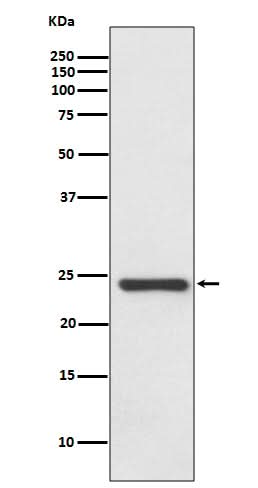Anti-HSPB8/HSP22 Rabbit Monoclonal Antibody Boster Bio