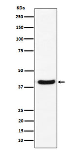 Anti-GNAI2 Rabbit Monoclonal Antibody Boster Bio